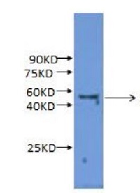 Glucan endo-1,3-beta-glucosidase in the group Antibodies for Plant/Algal / Carbohydrates at Agrisera AB (Antibodies for research) (AS15 2890)